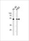 Myocyte Enhancer Factor 2C antibody, MBS9204480, MyBioSource, Western Blot image 