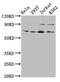ALG9 Alpha-1,2-Mannosyltransferase antibody, CSB-PA867161LA01HU, Cusabio, Western Blot image 