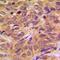 Melanoma-associated antigen 1 antibody, orb214221, Biorbyt, Immunohistochemistry paraffin image 