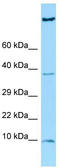 Heparan-Alpha-Glucosaminide N-Acetyltransferase antibody, TA337878, Origene, Western Blot image 
