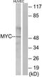 c-Myc antibody, TA326222, Origene, Western Blot image 