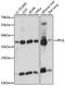 Ribosomal Protein L6 antibody, 15-873, ProSci, Western Blot image 