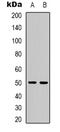 Protein Phosphatase 4 Regulatory Subunit 2 antibody, LS-C368923, Lifespan Biosciences, Western Blot image 