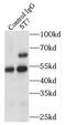 Suppressor of tumorigenicity 7 protein antibody, FNab08273, FineTest, Immunoprecipitation image 