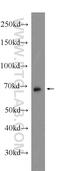 Ankyrin repeat domain-containing protein 13C antibody, 24000-1-AP, Proteintech Group, Western Blot image 