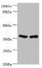 Carbonate dehydratase VB antibody, CSB-PA896871EA01HU, Cusabio, Western Blot image 