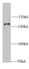 Ring Finger Protein 40 antibody, FNab07358, FineTest, Western Blot image 