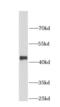 Histone deacetylase 8 antibody, FNab03805, FineTest, Western Blot image 