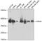 Serine-threonine kinase receptor-associated protein antibody, GTX33528, GeneTex, Western Blot image 