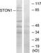 Stonin-1 antibody, TA315144, Origene, Western Blot image 