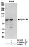 Cyclin And CBS Domain Divalent Metal Cation Transport Mediator 4 antibody, A304-469A, Bethyl Labs, Immunoprecipitation image 
