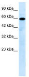 Mucolipin 1 antibody, TA338593, Origene, Western Blot image 
