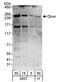 Dicer 1, Ribonuclease III antibody, A301-937A, Bethyl Labs, Western Blot image 