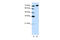 A-Kinase Anchoring Protein 8 Like antibody, 29-006, ProSci, Immunohistochemistry paraffin image 