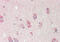 ST6 N-Acetylgalactosaminide Alpha-2,6-Sialyltransferase 1 antibody, ARP47446_P050, Aviva Systems Biology, Immunohistochemistry frozen image 
