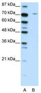 Leucine Zipper Tumor Suppressor 1 antibody, TA345318, Origene, Western Blot image 