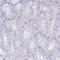 Keratin, type II cytoskeletal 78 antibody, PA5-58902, Invitrogen Antibodies, Immunohistochemistry frozen image 
