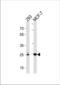 Carbonic anhydrase 2 antibody, TA324918, Origene, Western Blot image 