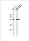 Protein DGCR14 antibody, PA5-49435, Invitrogen Antibodies, Western Blot image 