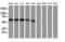 Potassium Voltage-Gated Channel Subfamily J Member 3 antibody, LS-C173669, Lifespan Biosciences, Western Blot image 