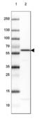 Protein Phosphatase 5 Catalytic Subunit antibody, NBP2-38812, Novus Biologicals, Western Blot image 