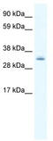 PDZ and LIM domain protein 1 antibody, TA342321, Origene, Western Blot image 