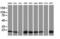 Destrin antibody, LS-C172799, Lifespan Biosciences, Western Blot image 