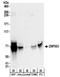 Zinc Finger Protein 503 antibody, NBP2-32130, Novus Biologicals, Western Blot image 