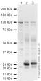 Nuclear Receptor Subfamily 3 Group C Member 2 antibody, ab64457, Abcam, Western Blot image 