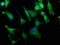 Exocyst Complex Component 7 antibody, CSB-PA007886LA01HU, Cusabio, Immunofluorescence image 