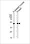 Hemojuvelin BMP Co-Receptor antibody, LS-C166852, Lifespan Biosciences, Western Blot image 
