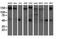 AP2M1 antibody, NBP2-00834, Novus Biologicals, Western Blot image 