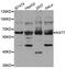 Histone acetyltransferase MYST2 antibody, orb178601, Biorbyt, Western Blot image 