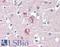 Disks large-associated protein 1 antibody, LS-B4171, Lifespan Biosciences, Immunohistochemistry paraffin image 