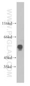 Endoplasmic Reticulum Oxidoreductase 1 Beta antibody, 18312-1-AP, Proteintech Group, Western Blot image 