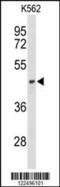 NADH-ubiquinone oxidoreductase chain 2 antibody, 63-922, ProSci, Western Blot image 