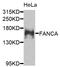 FA Complementation Group A antibody, A7671, ABclonal Technology, Western Blot image 
