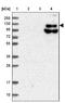 Family With Sequence Similarity 186 Member B antibody, NBP1-88390, Novus Biologicals, Western Blot image 