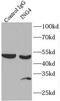 Inhibitor Of Growth Family Member 4 antibody, FNab04314, FineTest, Immunoprecipitation image 