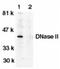 Deoxyribonuclease-2-alpha antibody, AP05789PU-N, Origene, Western Blot image 