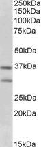 Autoimmune Regulator antibody, 45-227, ProSci, Enzyme Linked Immunosorbent Assay image 