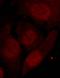 Histone Deacetylase 2 antibody, GTX50236, GeneTex, Immunocytochemistry image 
