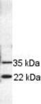 RAB11B, Member RAS Oncogene Family antibody, ab3612, Abcam, Western Blot image 