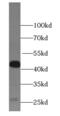 HLA class I histocompatibility antigen, B-51 alpha chain antibody, FNab03897, FineTest, Western Blot image 
