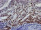 Ubiquitin Conjugating Enzyme E2 E3 antibody, LS-C173916, Lifespan Biosciences, Immunohistochemistry frozen image 