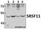 Serine And Arginine Rich Splicing Factor 11 antibody, A09323-1, Boster Biological Technology, Western Blot image 