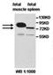 Zinc Finger And BTB Domain Containing 16 antibody, orb77688, Biorbyt, Western Blot image 