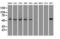 Cytochrome P450 Family 7 Subfamily B Member 1 antibody, LS-C114345, Lifespan Biosciences, Western Blot image 
