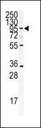 ADAMTS13 antibody, 62-911, ProSci, Western Blot image 