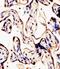 HERV-K_1q22 provirus ancestral Env polyprotein antibody, M15907, Boster Biological Technology, Immunohistochemistry paraffin image 